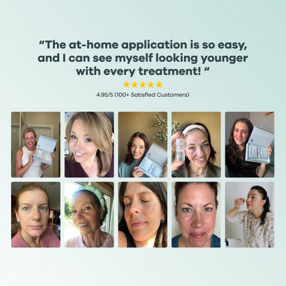 Seranova Micro Infusion Hyaluronic Acid Collagen Peptide 3 Month Supply