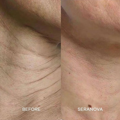 Seranova Micro Infusion Hyaluronic Acid Collagen Peptide 3 Month Supply